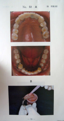 108b52歯科