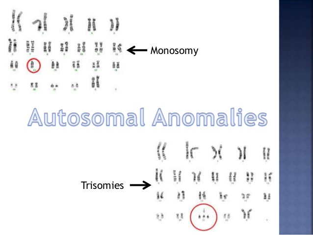 chromosomal-anomalies-7-638.jpg