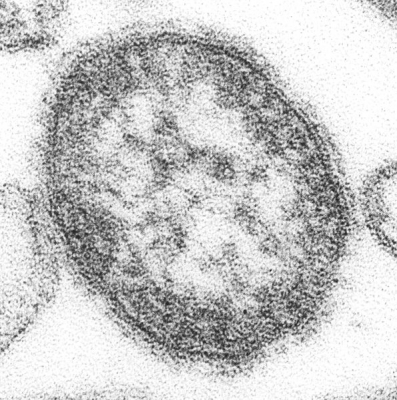 595px-Measles_virus.jpg